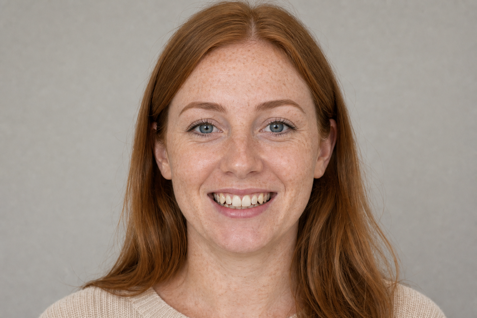 After - Orthodontic Correction
